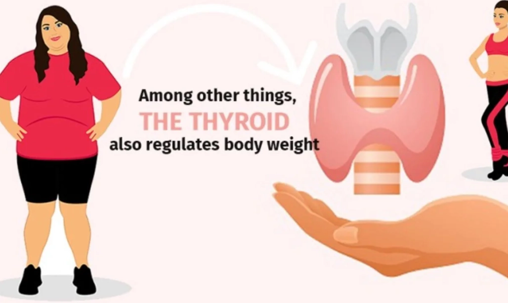 Thyroid issues in women weight loss