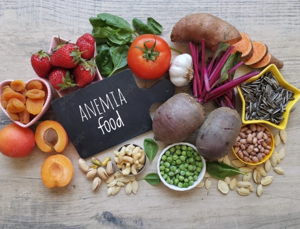 how to treat anemia with food how to treat anemia with food