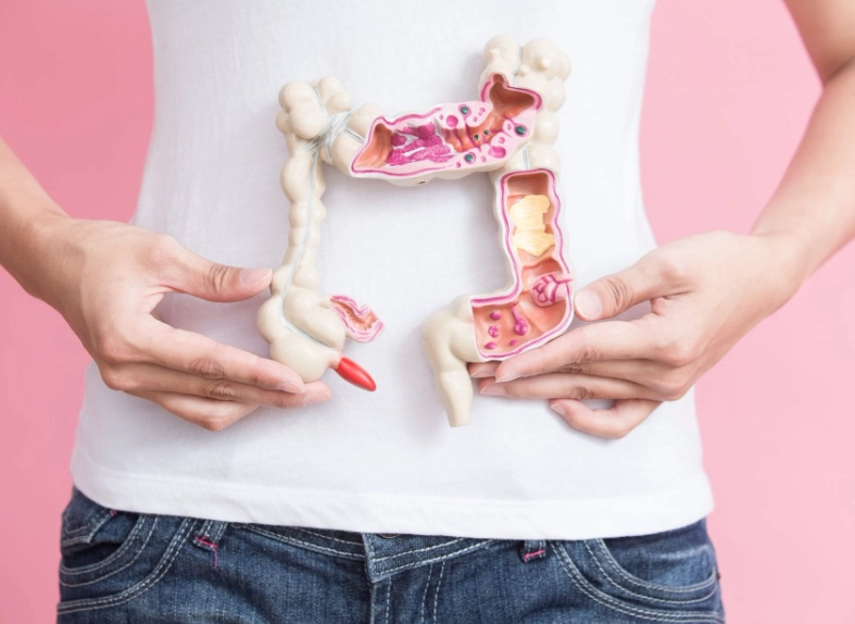 colorectal cancer symptoms women