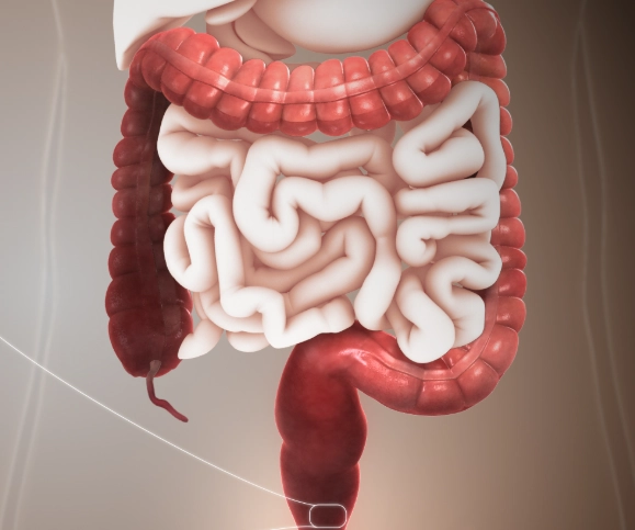 signs of colorectal cancer in females