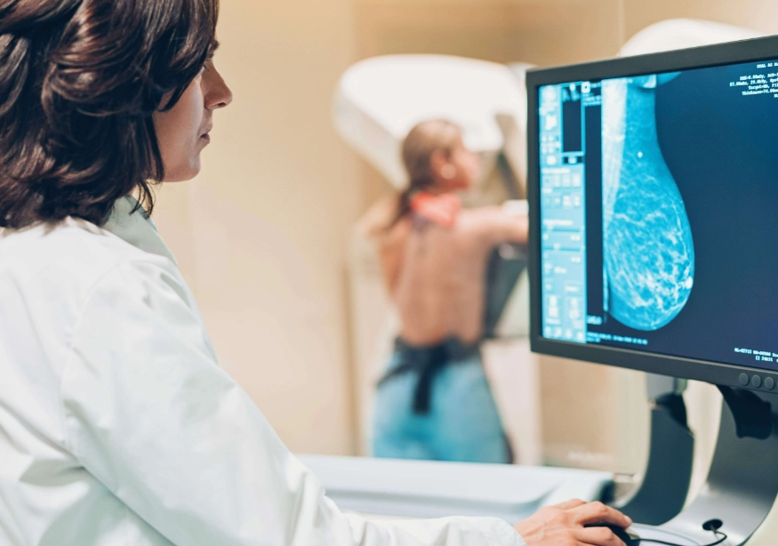 mammogram screening guidelines