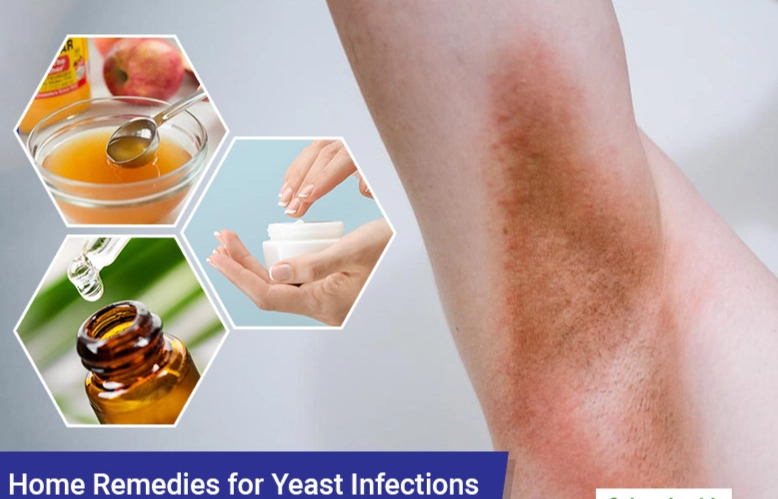 best yeast infection treatment best yeast infection treatment