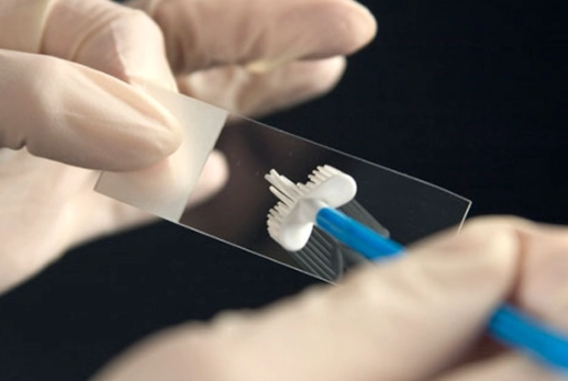 abnormal pap smear results abnormal pap smear results