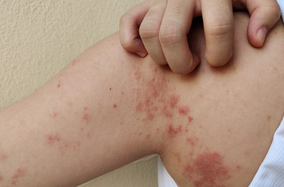 women autoimmune disorders women autoimmune disorders