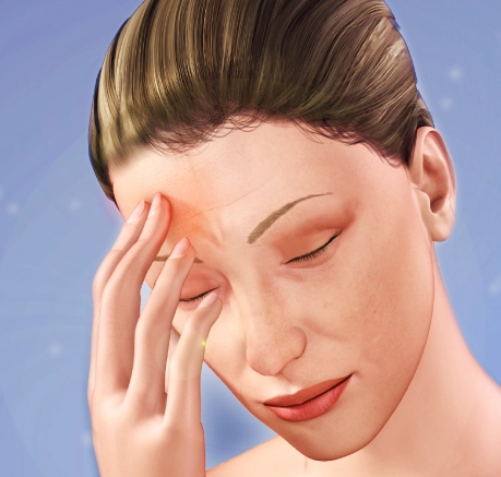 CFS symptoms CFS symptoms