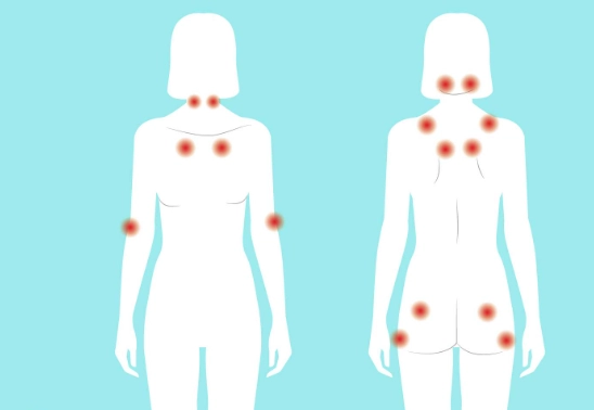 fibromyalgia symptoms in women fibromyalgia symptoms in women
