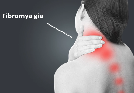 managing fibromyalgia in women managing fibromyalgia in women