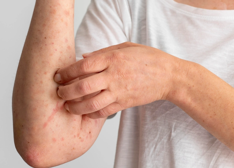 common female health issues