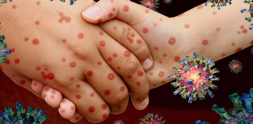 common female health issues