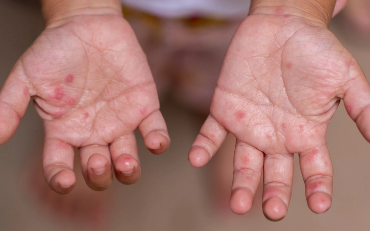 most common diseases in women