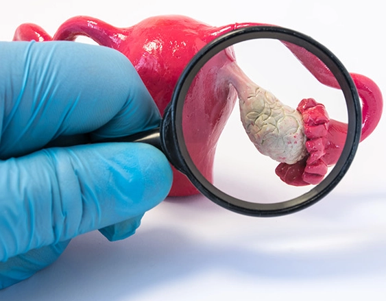 premature ovarian failure premature ovarian failure