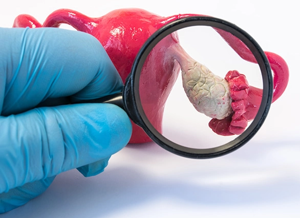 PCOS symptoms checklist PCOS symptoms checklist