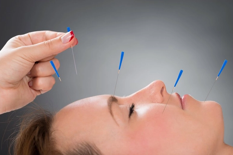 women's health acupuncture