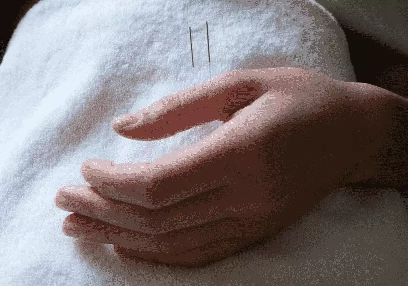 women's health acupuncture