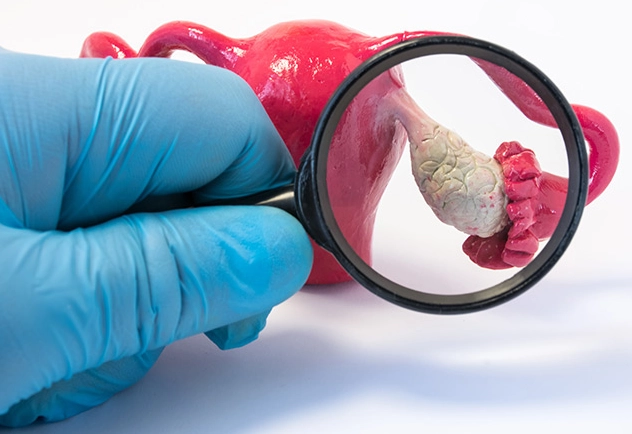 ovarian cyst symptoms ovarian cyst symptoms