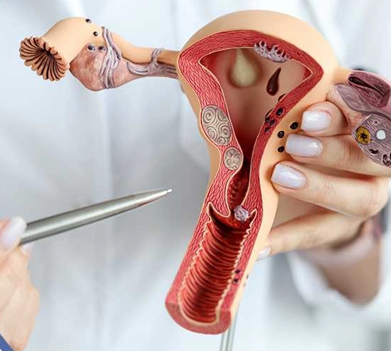 PCOS treatment PCOS treatment