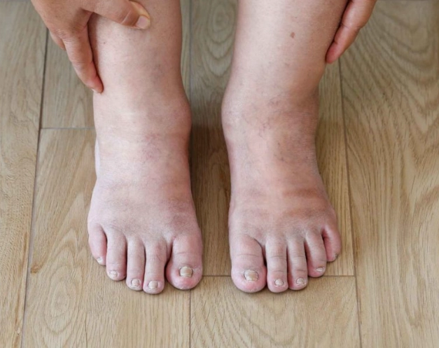 female diabetes symptoms