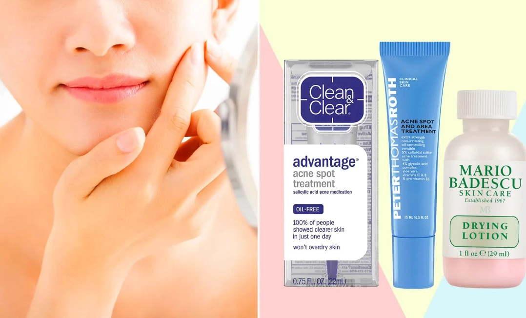 natural acne remedies