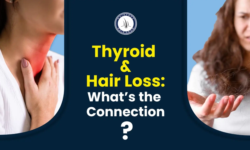 hypothyroidism hair loss