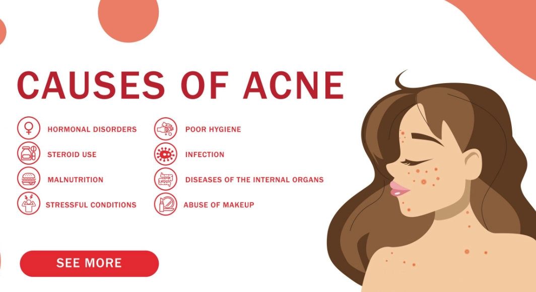 best products for acne