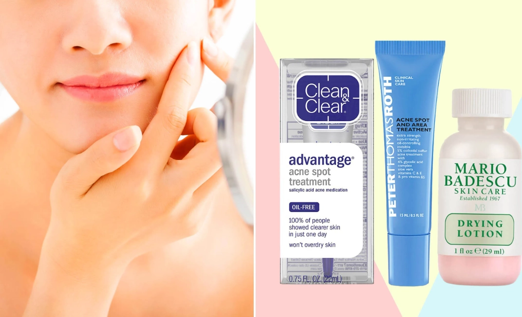 hormonal acne treatment