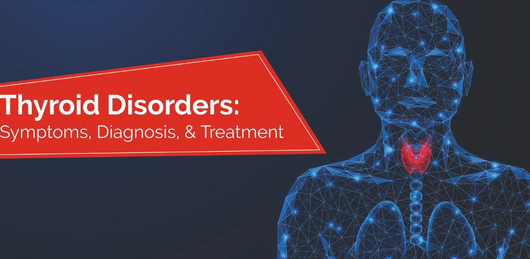 hyperthyroidism in females