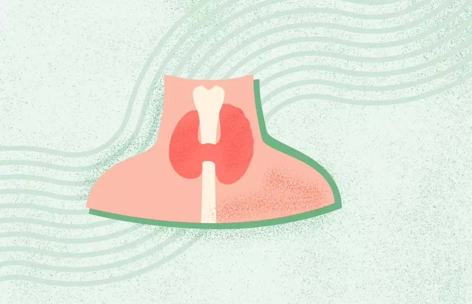 hypothyroidism age of onset