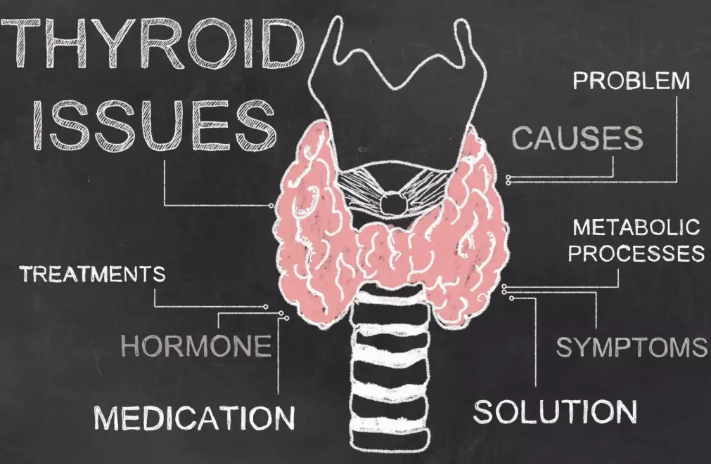 thyroid disorder management thyroid disorder management