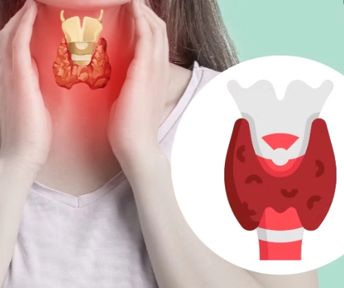 hypothyroidism symptoms female