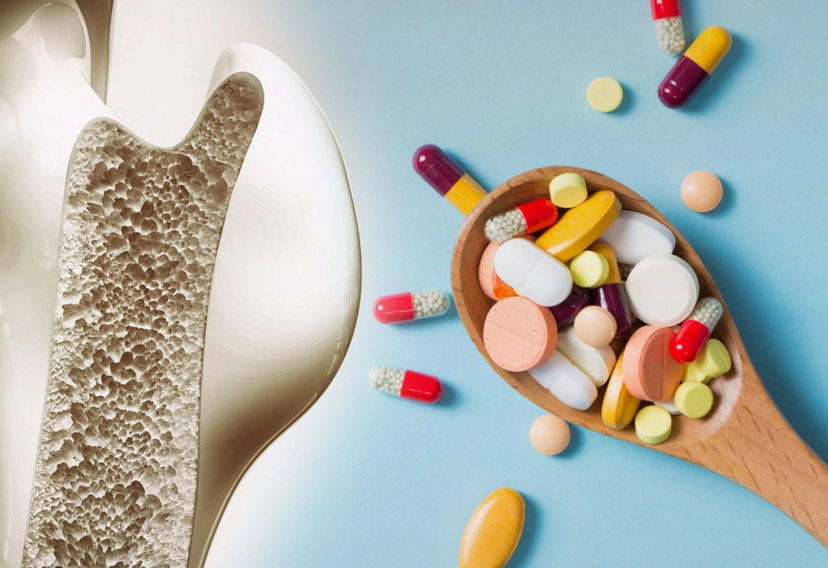 osteoporosis medication list
