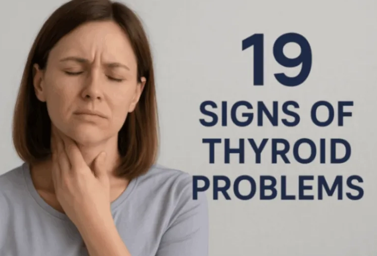 thyroid symptoms in women