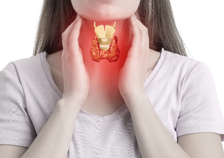 female thyroid problems