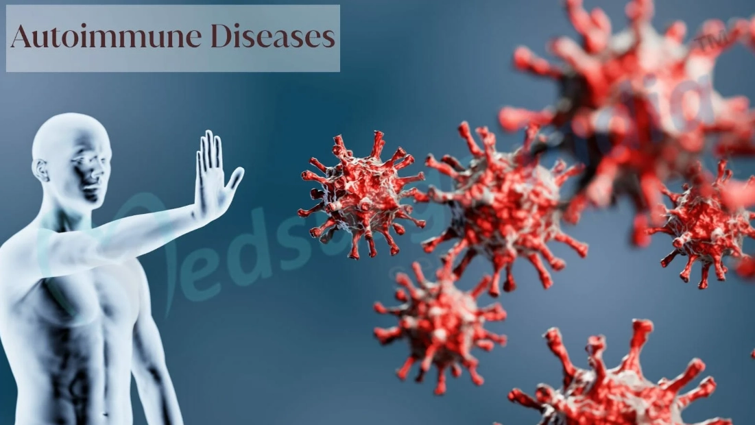 How do autoimmune diseases make you feel?